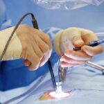 How Predictive Models Guide Opioid-Free Pain Management in Spine Surgery