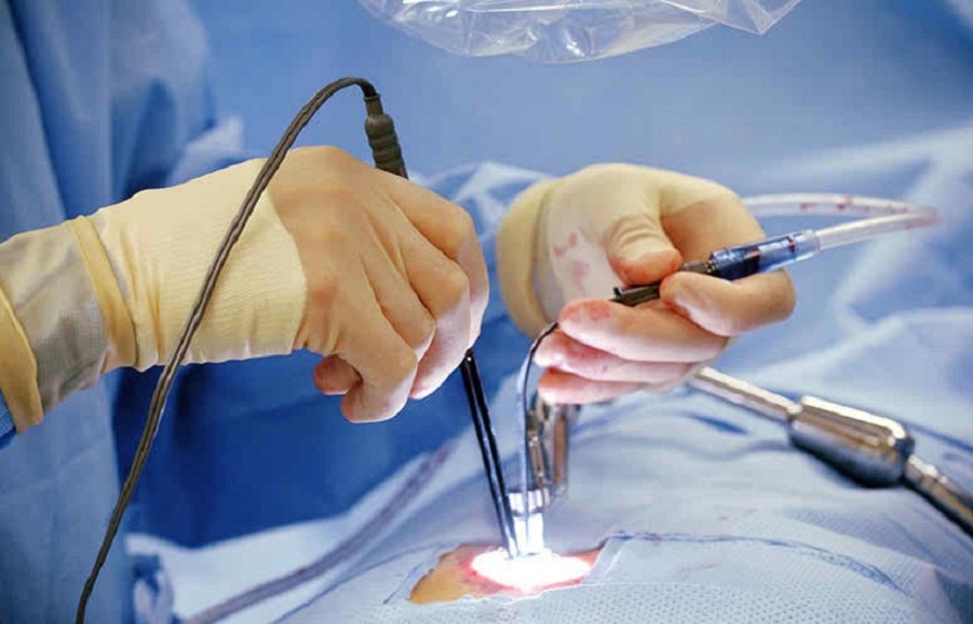 How Predictive Models Guide Opioid-Free Pain Management in Spine Surgery